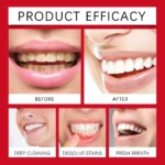 SP-8 Probiotic Toothpaste – Fresh Breath & Deep Cleaning Oral Care