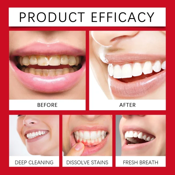 SP-8 Probiotic Toothpaste – Fresh Breath & Deep Cleaning Oral Care